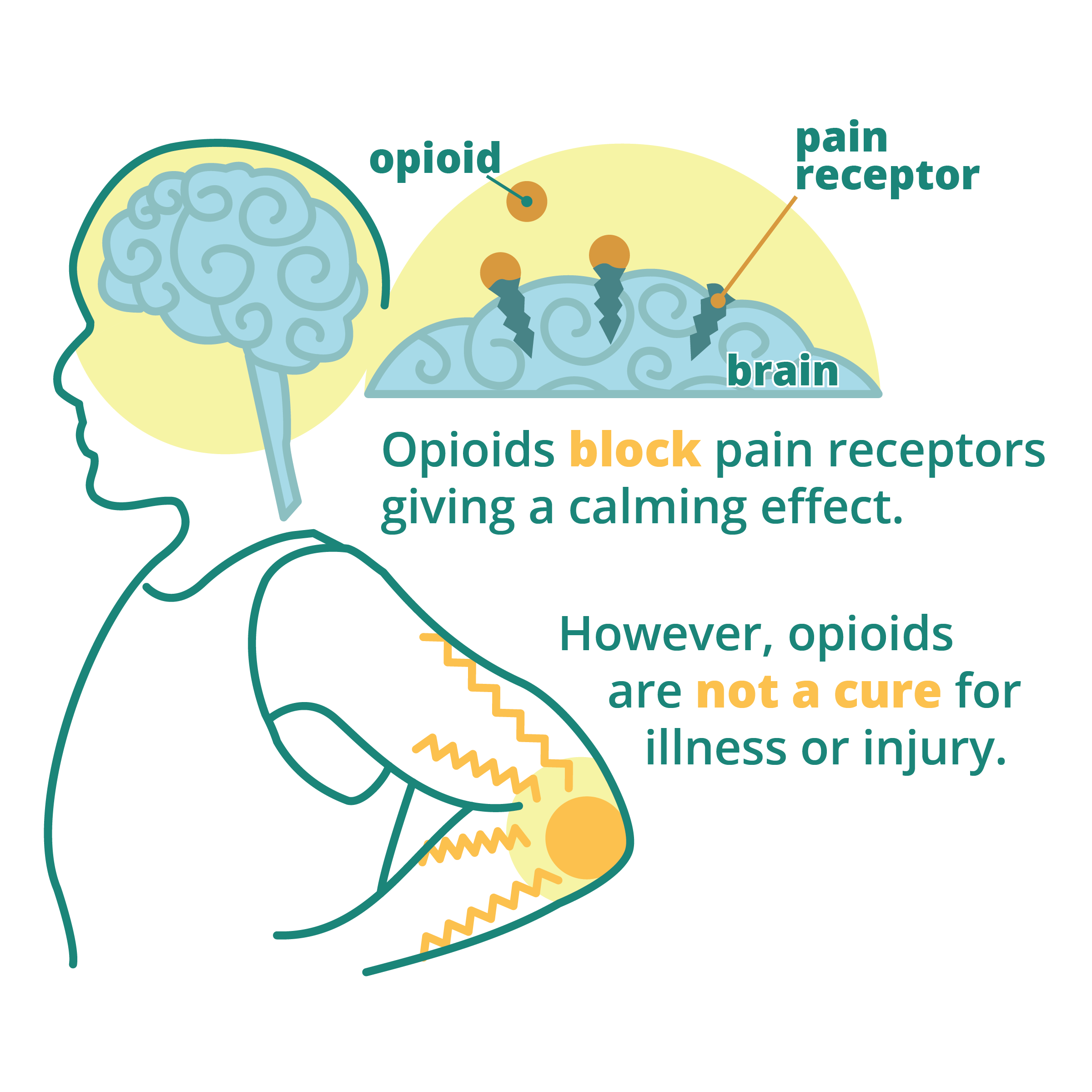 Infographic: Opioids block pain receptors giving a calming effect. However opioids are not a cure for illness or injury.